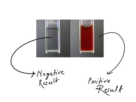 Seliwanoffs Test Principle and Procedure .